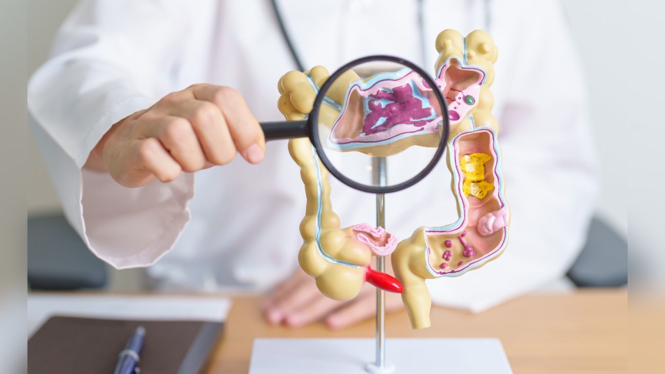 Imasgem de pessoa colocando lupa em intestino