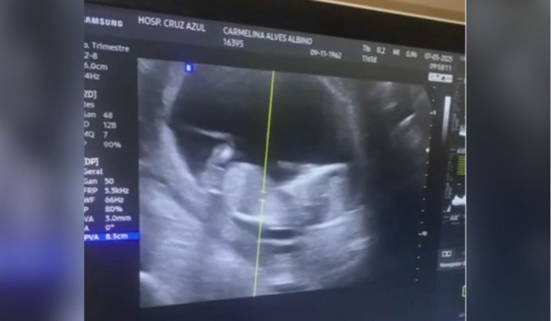Ultrassom Ultrassom de criança na barriga de grávida