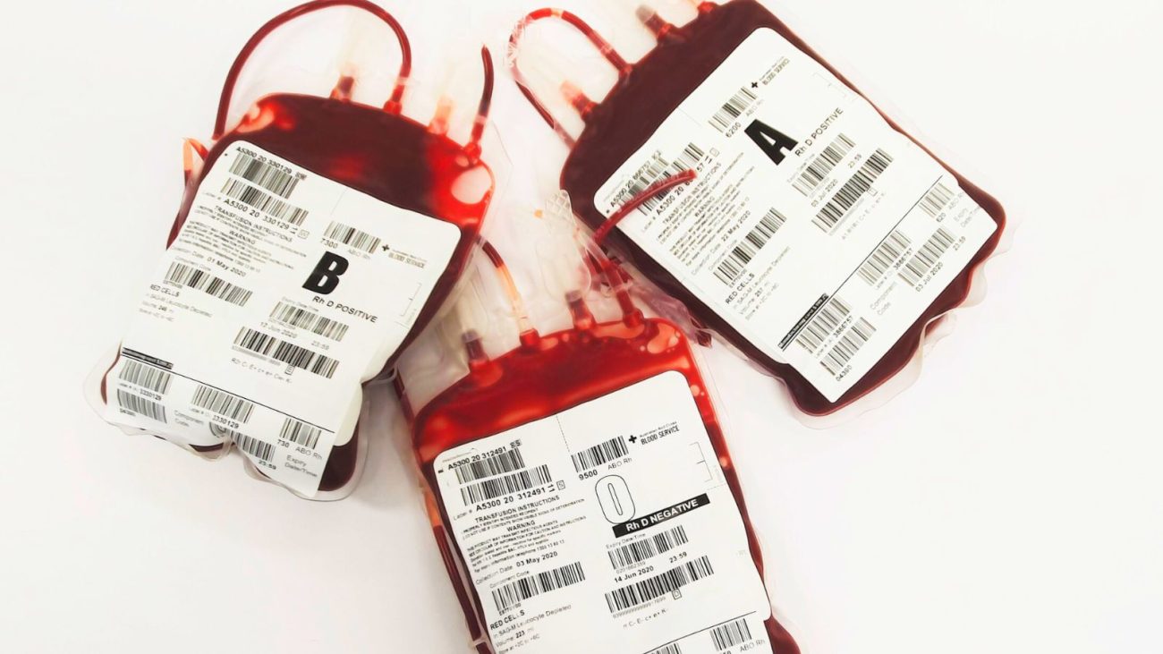 Imagem mostra três bolsas de sangue, uma do tipo A, outra do tipo B e outra do tipo O.