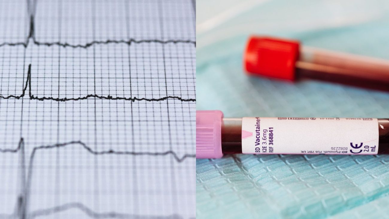 À esquerda, um eletrocardiograma está sendo realizado. À direita, dois tubos de sangue foram dispostos em uma superfície de laboratório.