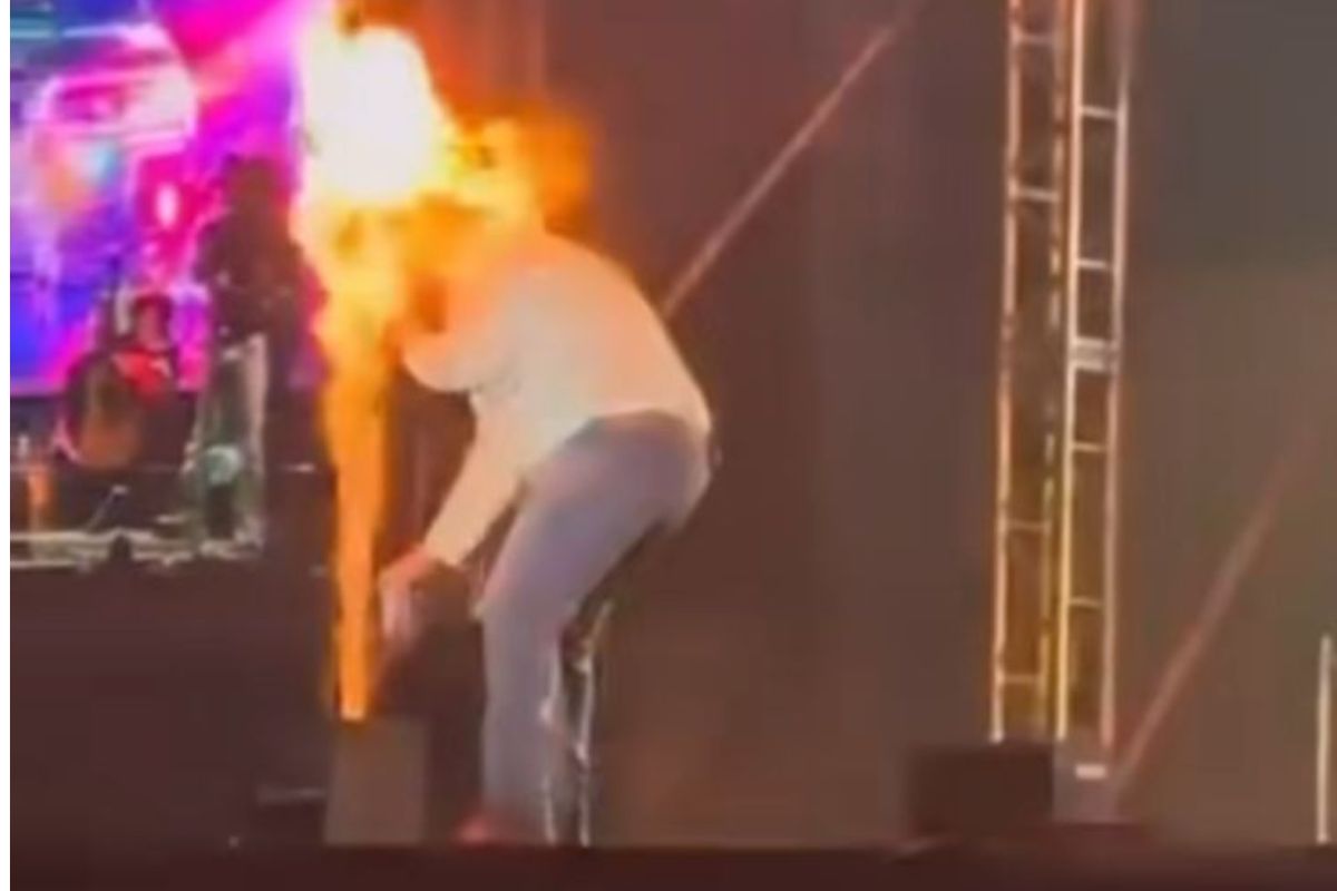 Cantor sertanejo é atingido por labareda de fogo no rosto