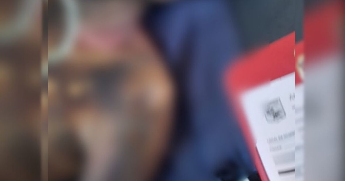 Foto borrada de homem que sofreu queimaduras e morreu