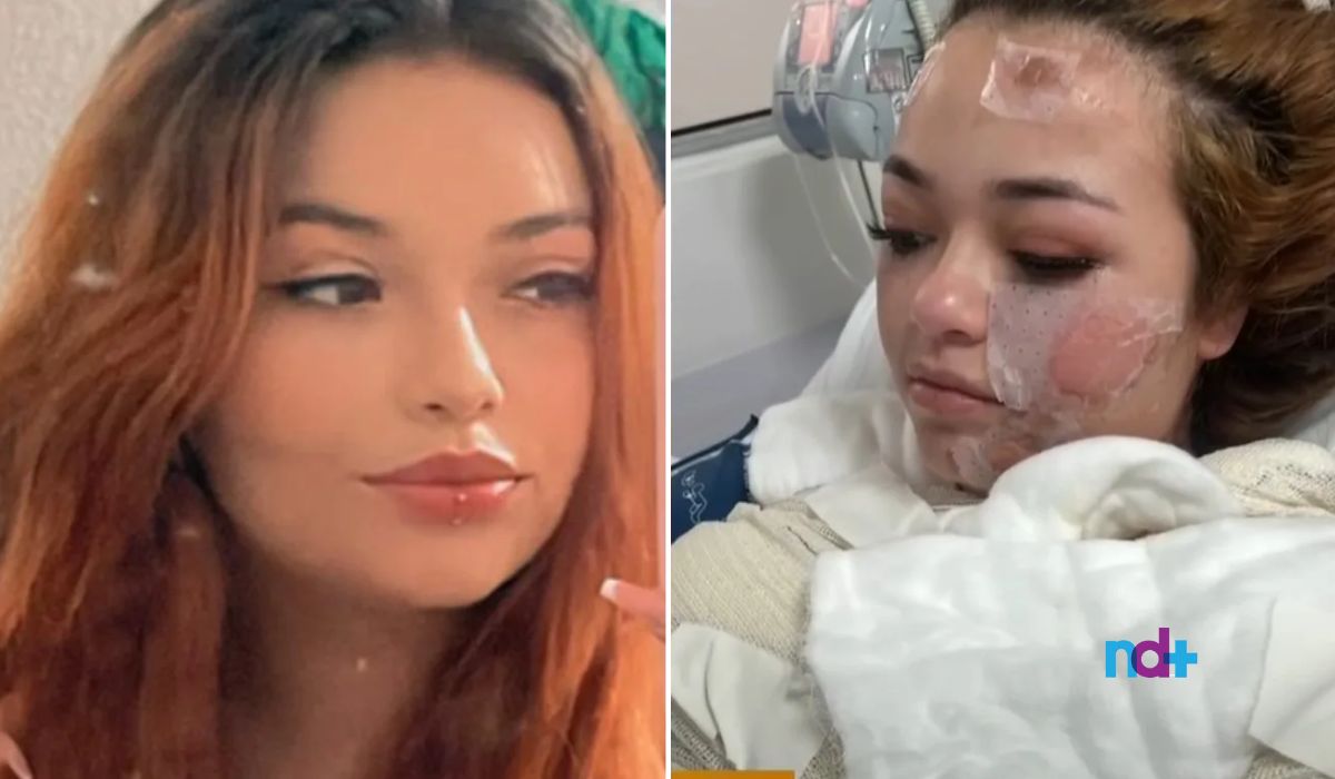 Morte em banheira de motel deixou vítima com queimaduras pelo corpo