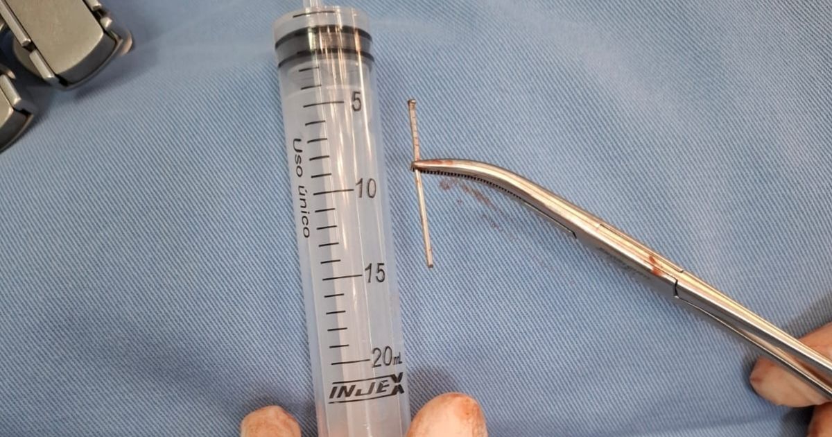 Prego Retirado do Coraça do Jovem