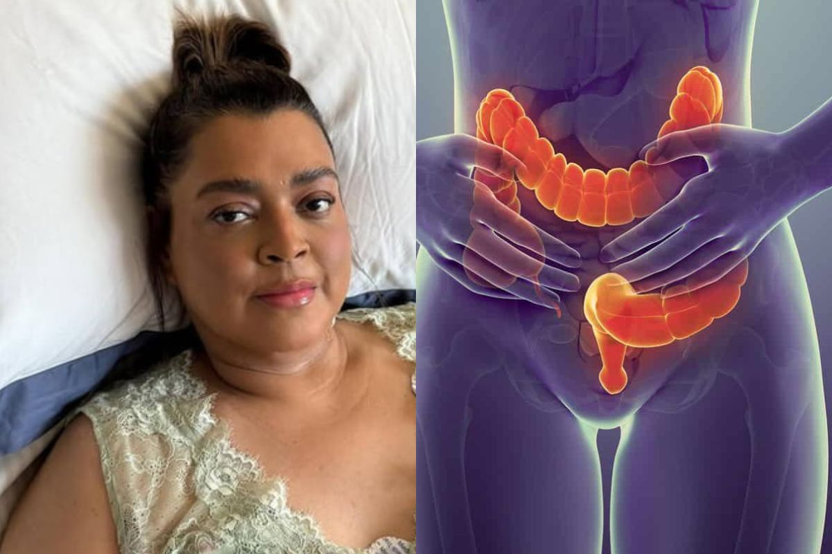Câncer colorretal de Preta Gil: entenda doença que mata 900 mil por ano