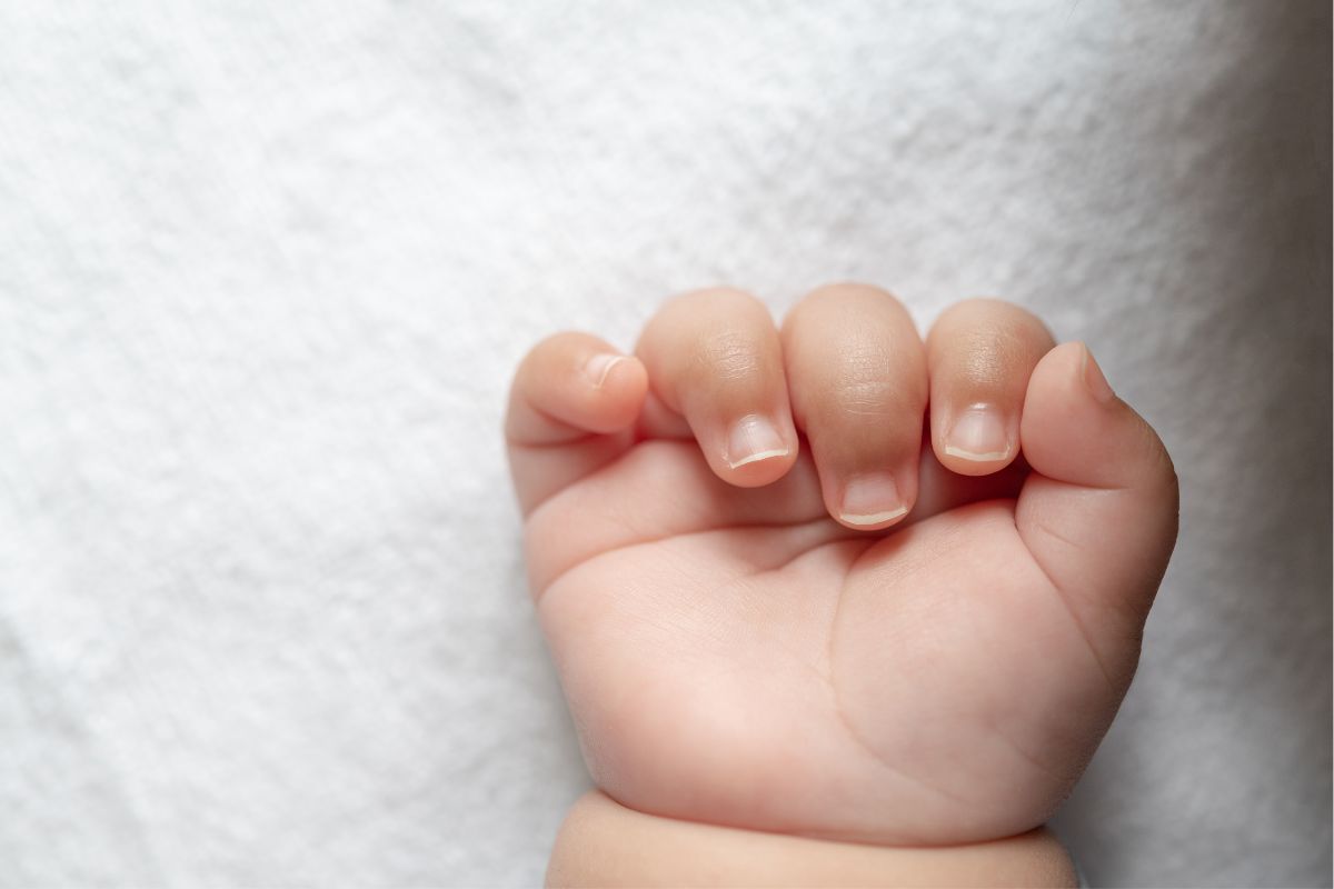Caso de queimadura em creche segue sob investigaçãoFoto: Divulgação/Freepik/ND Mais