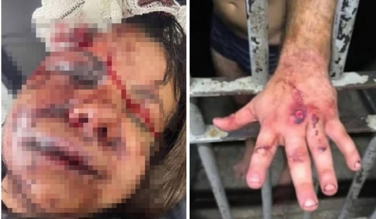 Igor Cabral foi preso em flagrante após desferir mais de 60 socos em Juliana Garcia