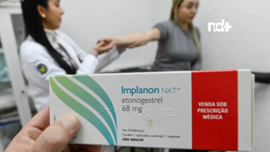 Florianópolis passa a oferecer Implanon de graça para mulheres