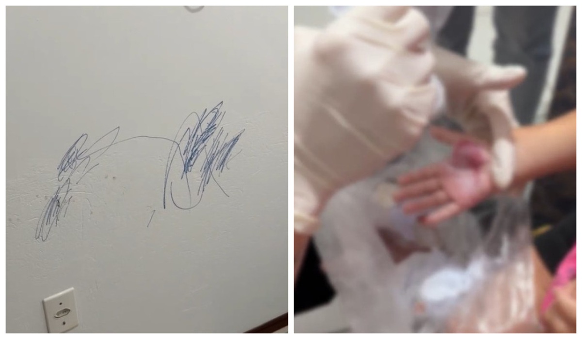 Caso de menina de 2 anos queimada pela madrasta é investigado pela Polícia Civil&nbsp;Foto: Rubens Angioletti/@rubensangioletti/Instagram/ND Mais