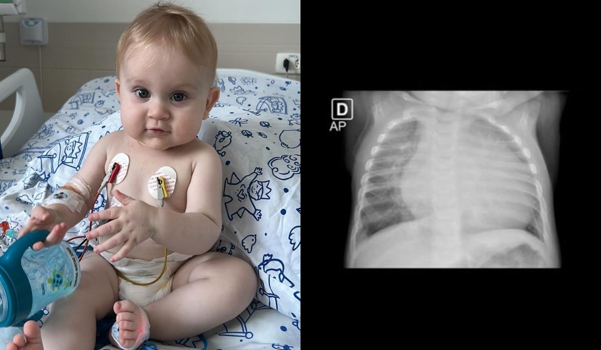 ‘Nosso milagre’: bebê que recebeu transplante de coração volta para casa em SC após sete meses