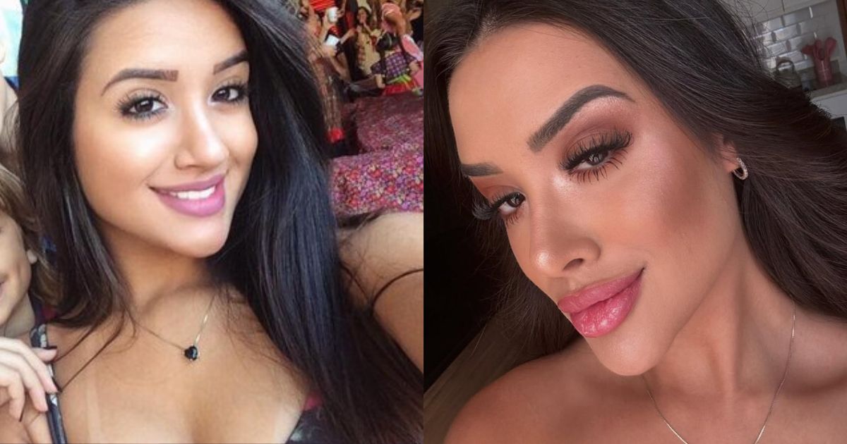 BBB 26: o antes e depois de Jordana, que já gastou R$ 40 mil em plásticas