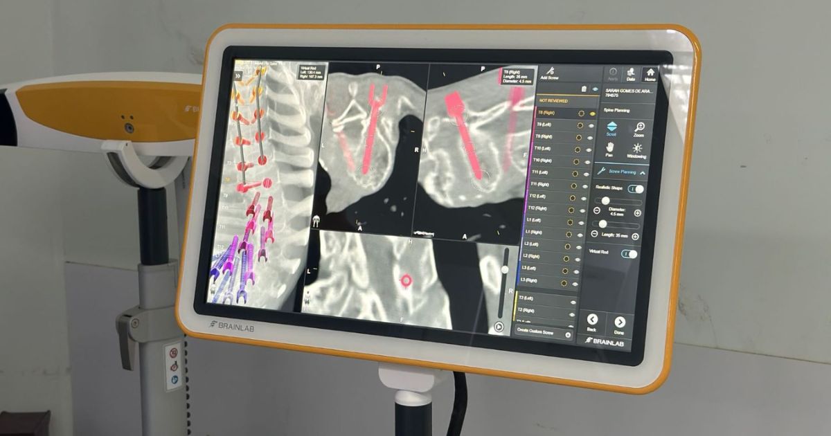 Procedimento reacende esperança de recuperação dos movimentos - Divulgação/SECOM/ND Mais