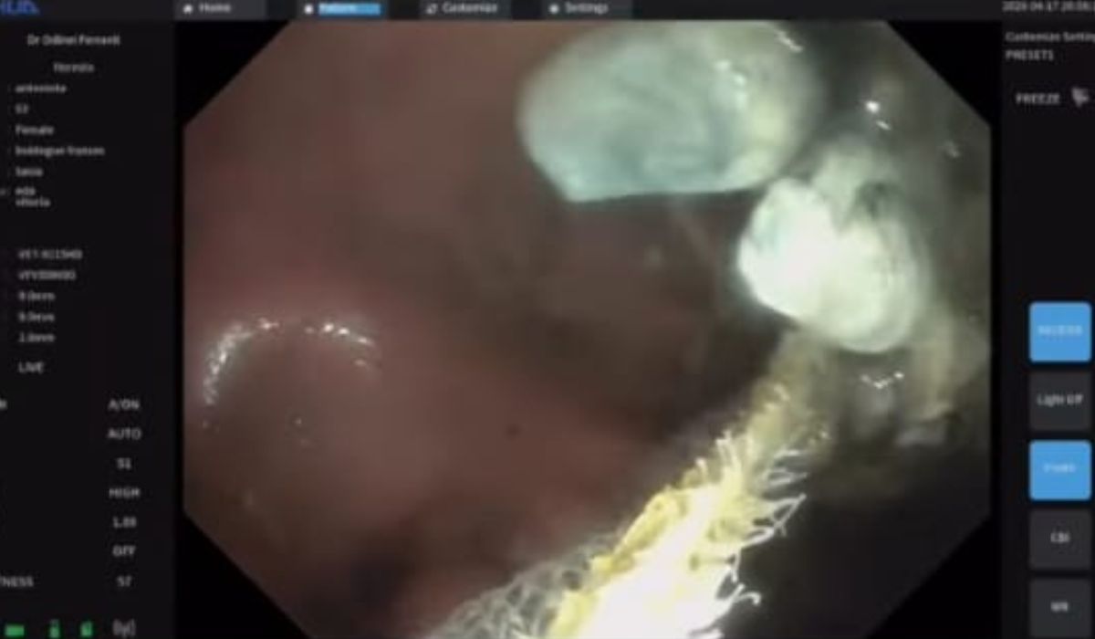 Exames de imagem revelaram a quantidade da droga no estômago do cãozinho - Reprodução/Redes Sociais/ND Mais