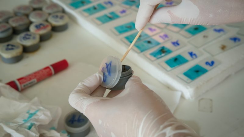 O novo exame do SUS utiliza anticorpos para identificar vestígios de sangue oculto nas fezes - Canva/ND Mais