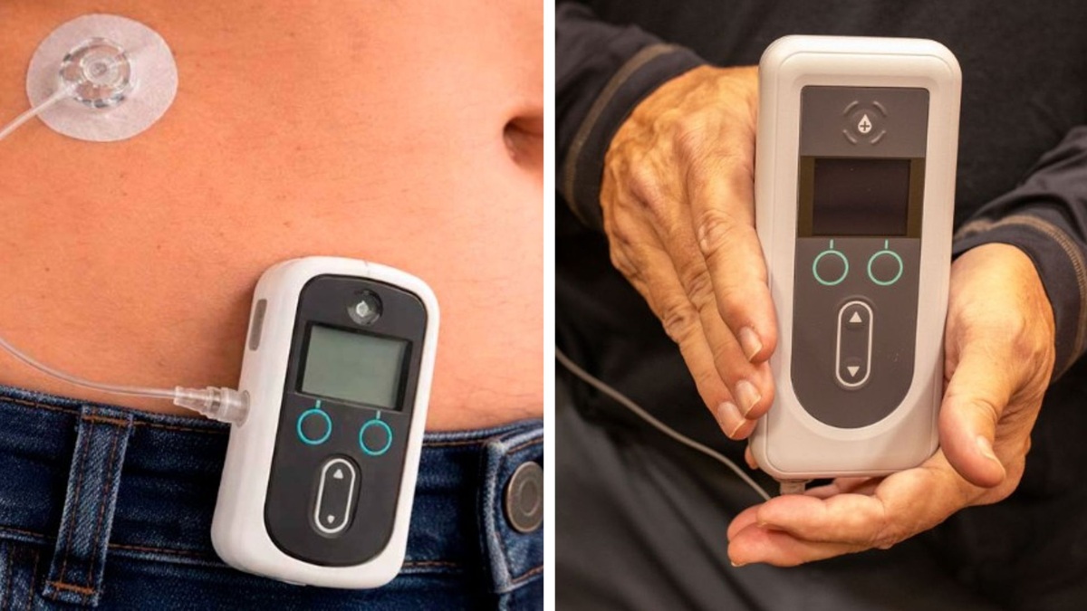 Anvisa libera novo produto para quem não responde aos tratamentos convencionais de Parkinson