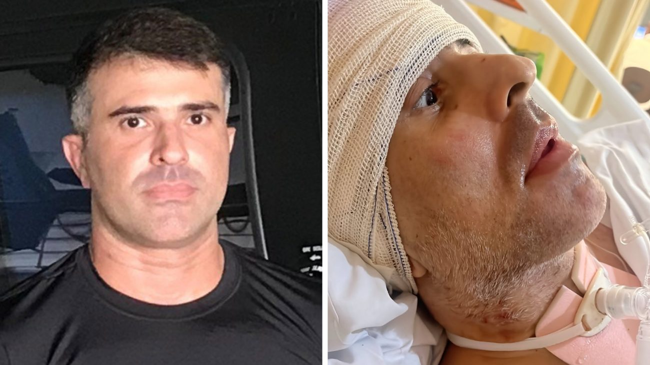 Grave': policial baleado na cabeça em operação no Rio luta contra infecção após cirurgia