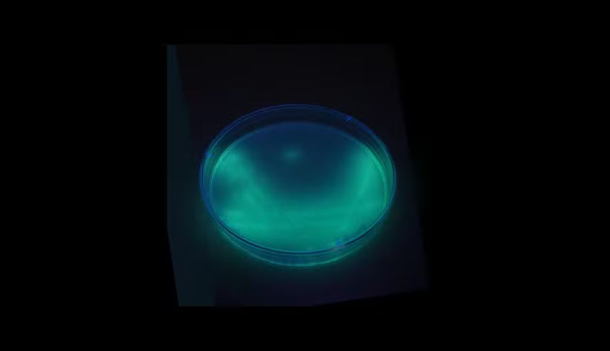 A bactéria da água Crystal: pseudomonas aeruginosaFoto: BiotechMichael/Reprodução/ND Mais