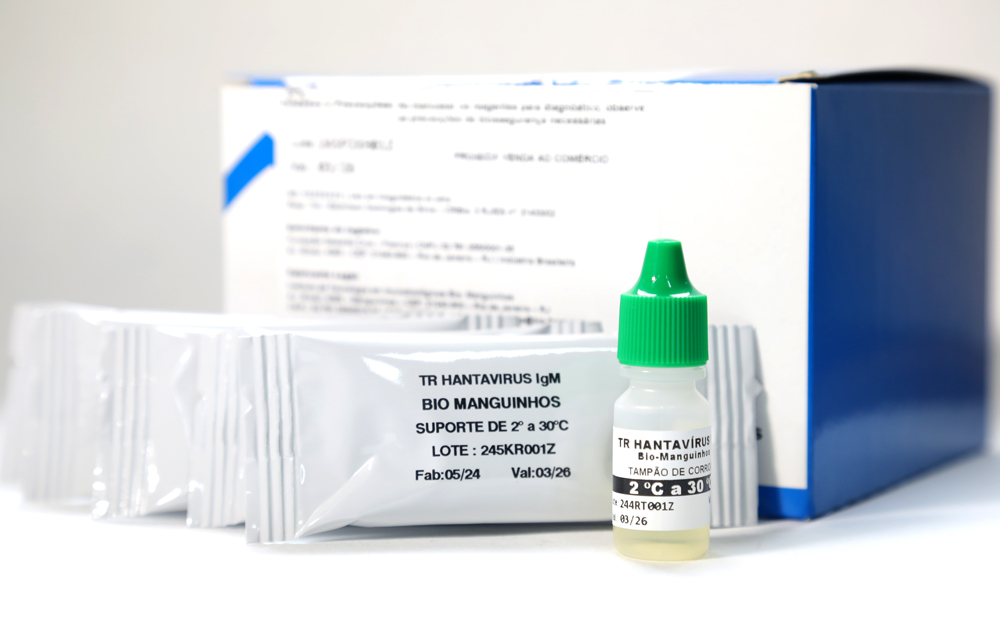 Teste rápido desenvolvido por meio de parceria entre IOC, Bio-Manguinhos e UFRJ é capaz de diagnosticar infecções por hantavírus em até 15 minutosFoto: Josué Damacena/IOC
