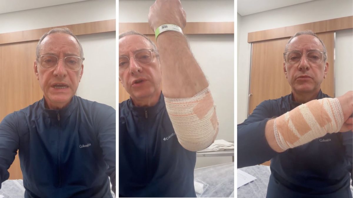 Jornalista da Globo leva pontos após ser atacado por pitbull durante passeio com cães