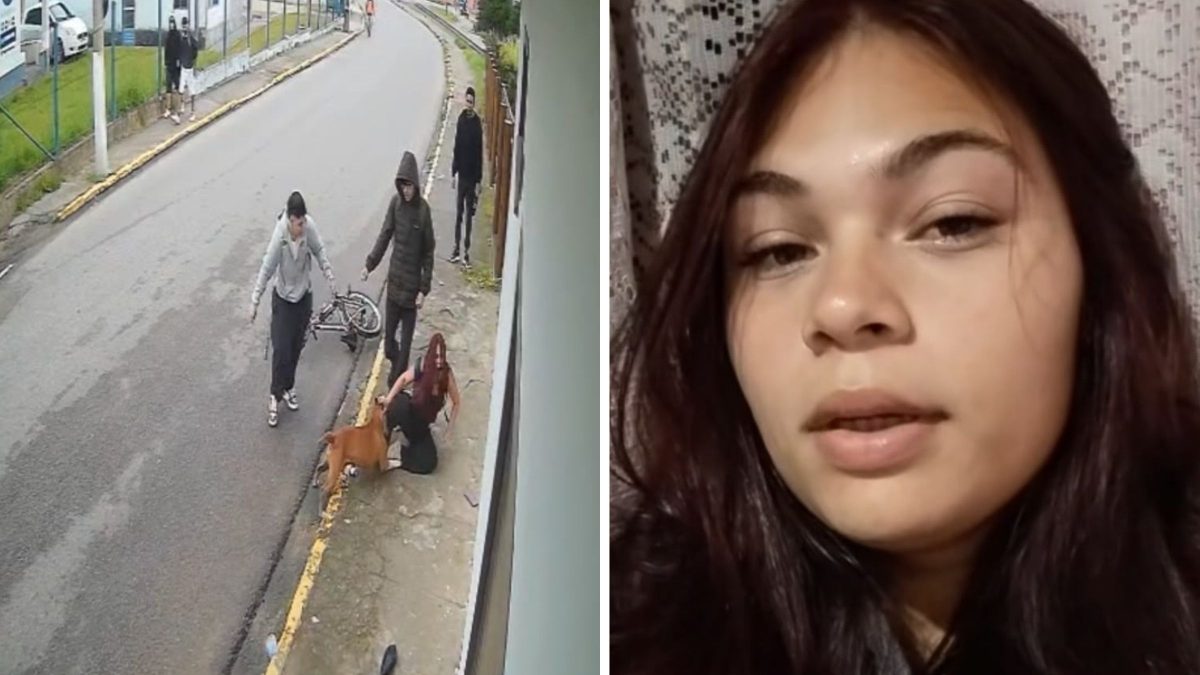VÍDEO: Jovem atacada por pitbull em SC desabafa após vídeo viralizar: ‘Foi um livramento’