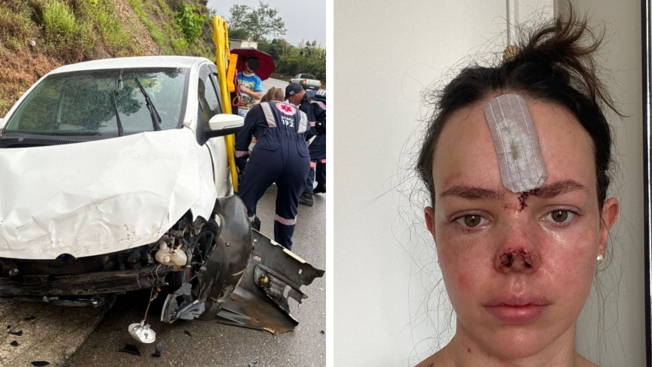 Após fraturar o rosto em um acidente, Alessandra enfrenta um delicado processo de reconstrução facial e inspira outras pessoas com sua história. Foto: Arquivo pessoal/ND Mais
