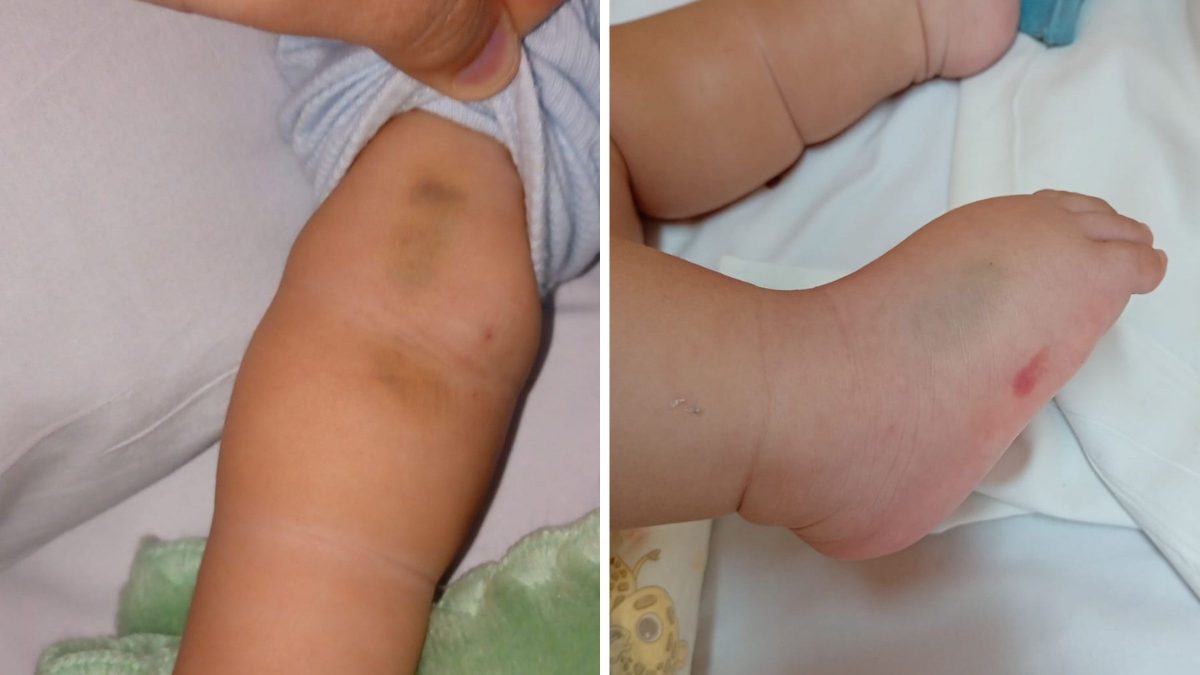 ‘Meu filho chorava de dor’: famílias denunciam falhas em atendimento pediátrico e hospital abre investigação em SC - QTU Questões do Universo