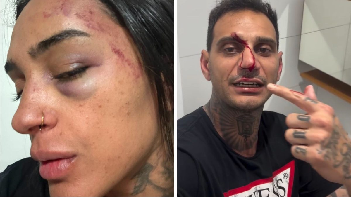 ‘Me espancou’: mulher denuncia parceiro por agressão e homem alega legítima defesa em Florianópolis - QTU Questões do Universo