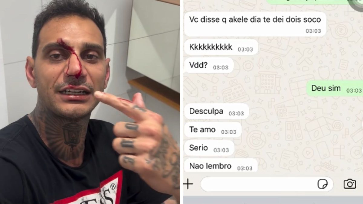 Homem acusado de agredir namorada denuncia parceira por furto e afirma ter sido agredido por ela meses antes - QTU Questões do Universo