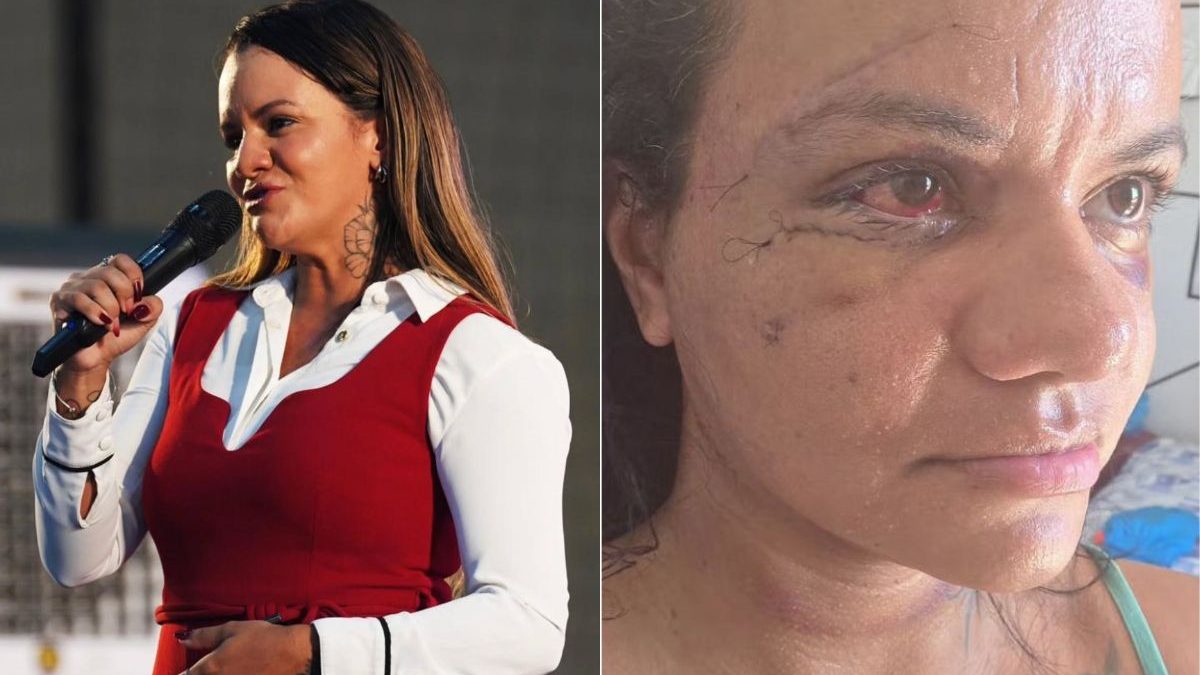 Um ano após agressão, mulher espancada com 61 socos é candidata a deputada estadual