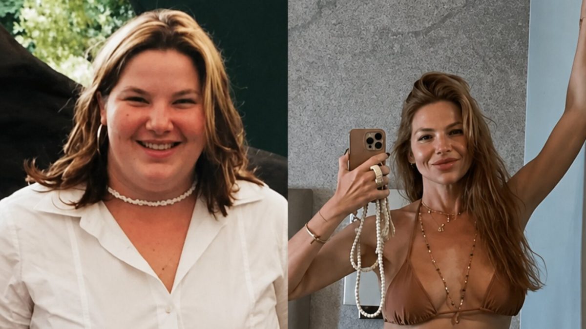 Repórter da Globo perde 75 kg após bariátrica e revela sequelas da cirurgia: “Perdi