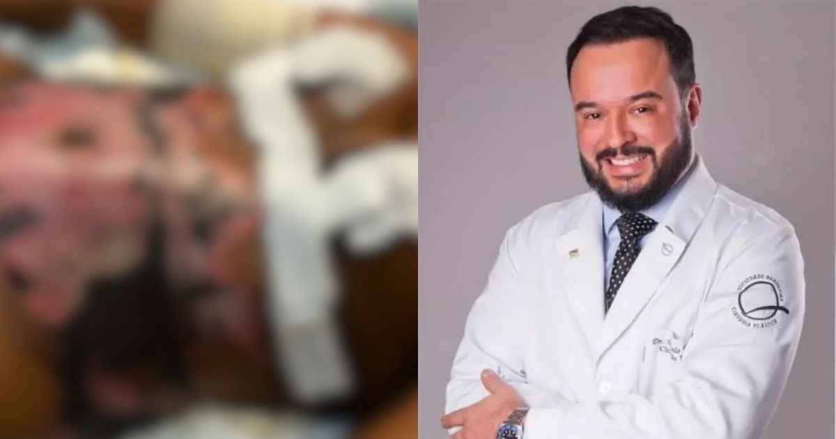 Paciente que teve 30% do corpo queimado por cirurgião ‘X-tudo’ em SC deve R$ 1 milhão em despesas médicas: ‘Ele segue atendendo’ - QTU Questões do Universo
