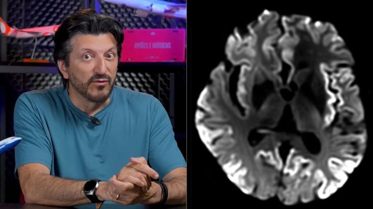 O que é Creutzfeldt-Jakob, doença sem tratamento diagnosticada em Lito Sousa que causa demência e perda progressiva dos movimentos - QTU Questões do Universo