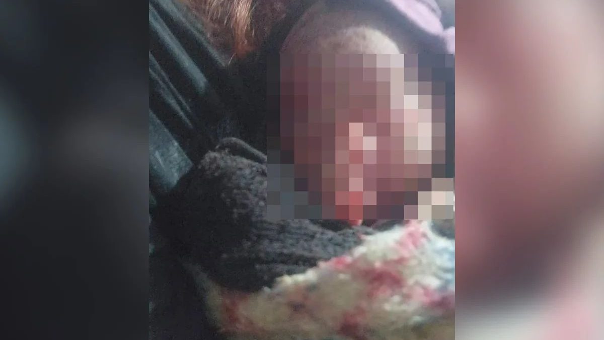 ‘Tá com cordão umbilical ainda’: Mulher pensou que era um gato, mas encontrou bebê recém-nascida chorando dentro de saco de lixo no PR - QTU Questões do Universo