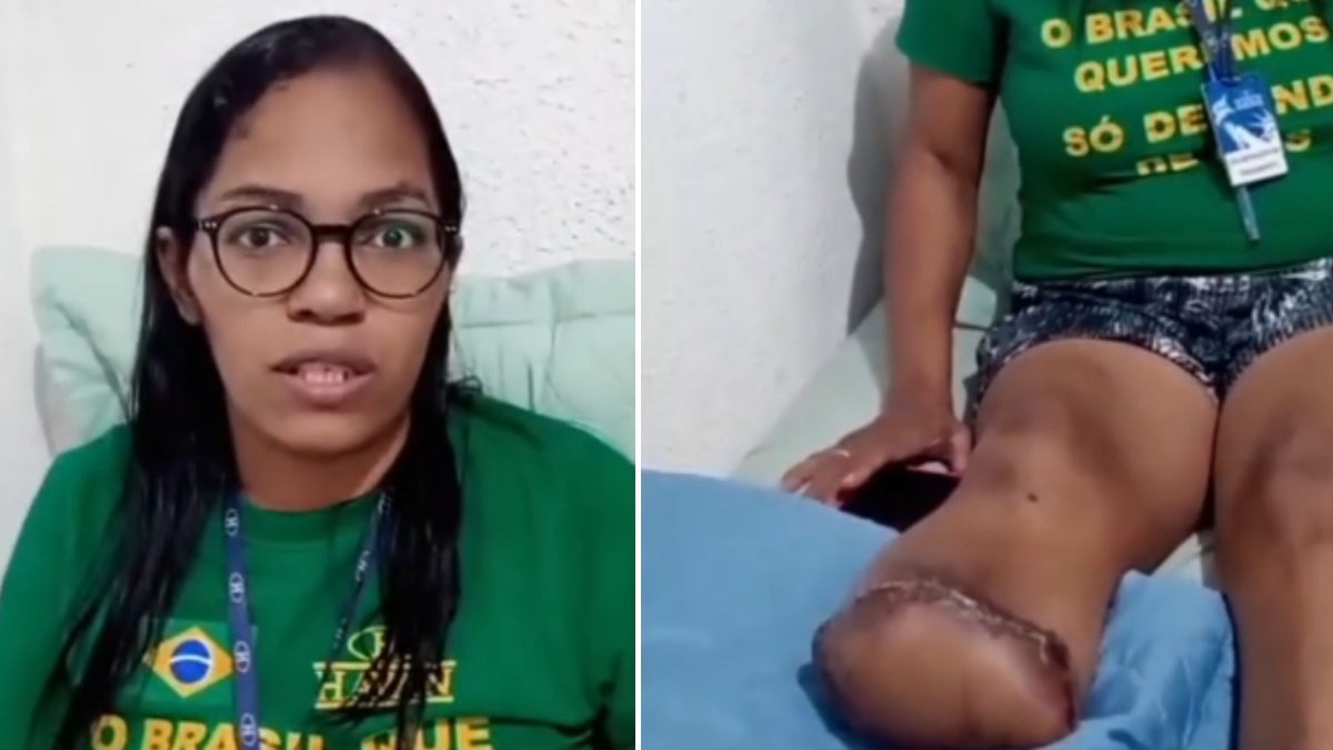 Funcionária da Havan que teve perna amputada e pediu prótese a Luciano Hang passa mal, é levada pelo marido ao hospital e morre após parada cardíaca