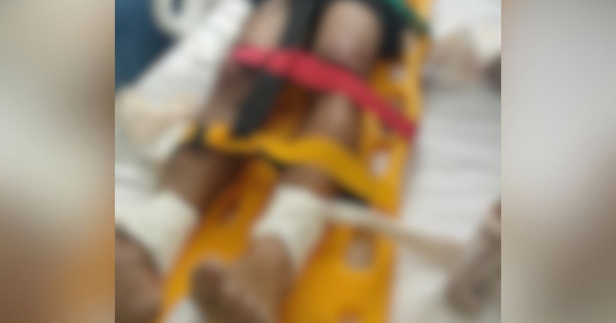 Guarda municipal é atacado durante prisão de homem suspeito de tentar roubar e agredir mulher em Balneário Camboriú