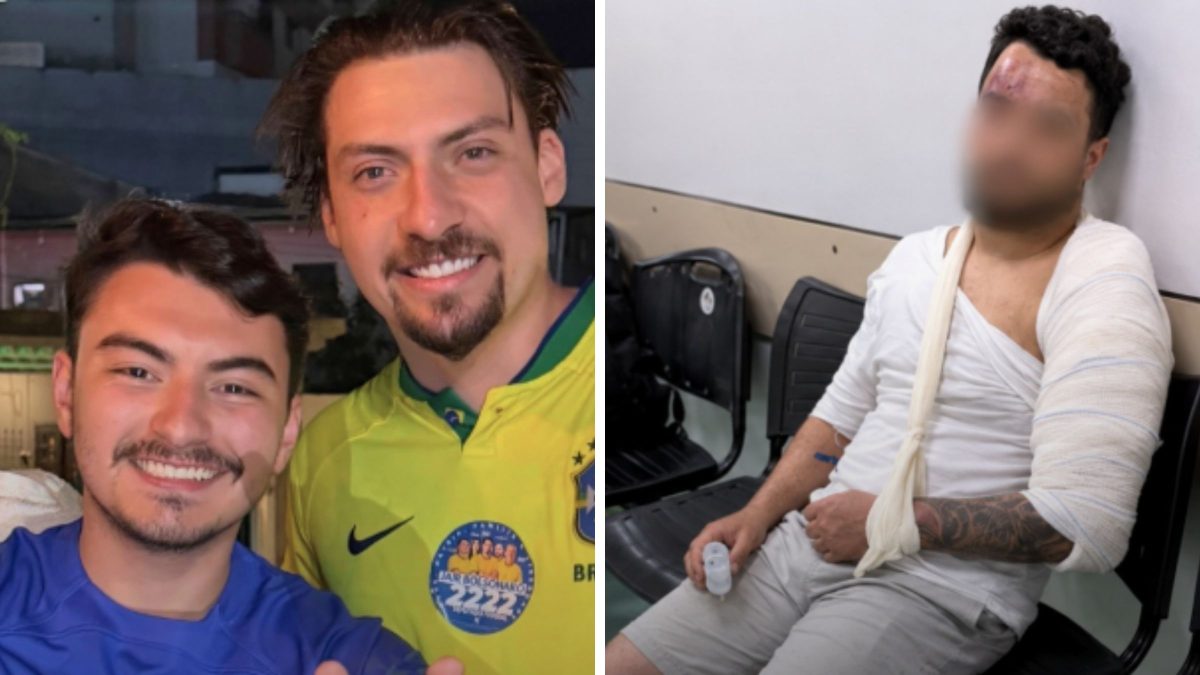 Após vitória de Lula, assessor de Jair Renan Bolsonaro é investigado por agredir com garrafadas e quebrar braço de primo que comemorava resultado