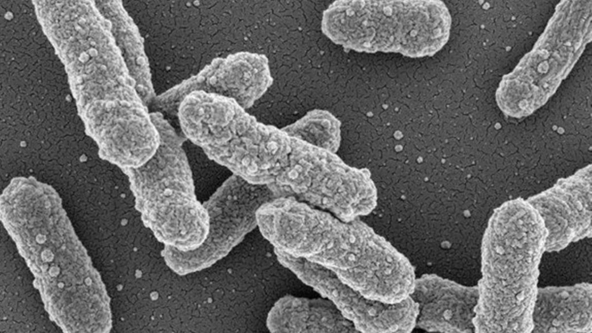 OMS investiga segunda morte após funcionária de laboratório de peste morrer na Rússia